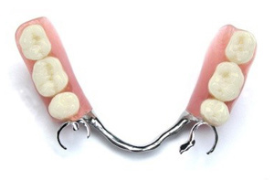 Prothèse dentaire métallique ou stellite inférieur